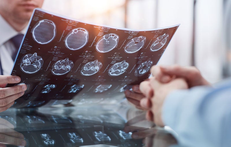 A doctor in a tie and another person reviewing brain MRI scans, with the scans reflecting on the table.